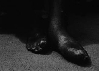 Gramps' Feet
Series: The Notion of Family